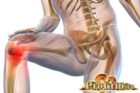 Боли в суставах Боли в суставах